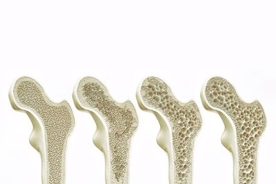 Osteologie