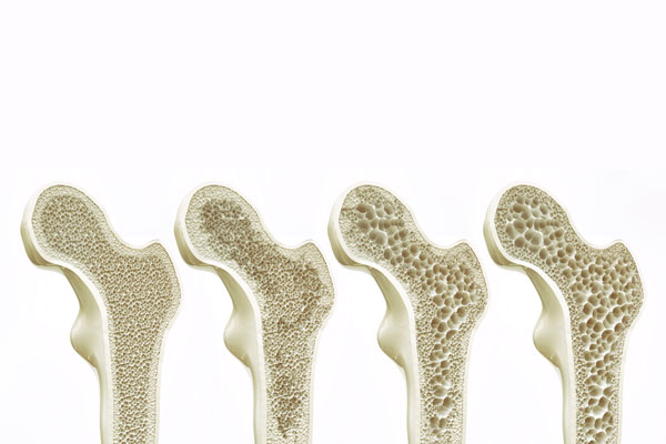Osteologie